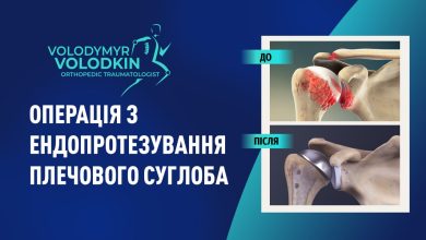 Ендопротезування плечового суглоба (плечова артропластика). Як відбувається операція